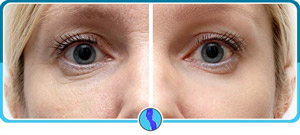 Age Spots Treatment Near Me in Fairfax, VA Age Spots Treatment Near Me in Fairfax, VA