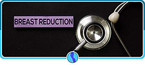 4 Questions to Ask About Breast Reduction Surgery 4 Questions to Ask About Breast Reduction Surgery