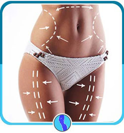 Liposuction Near Me in Fairfax, VA