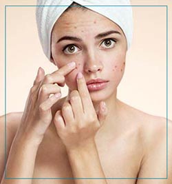 Acne and Scar Treatment Near Me in Fairfax, VA