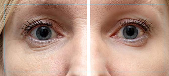 Age Spots Treatment Near Me in Fairfax, VA Age Spots Treatment Near Me in Fairfax, VA