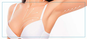 Breast Augmentation Surgery Near Me in Fairfax, VA