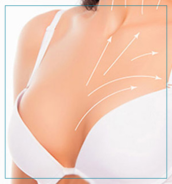 Breast Augmentation Surgery Near Me in Fairfax, VA