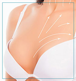 Breast Augmentation Surgery Near Me in Fairfax, VA