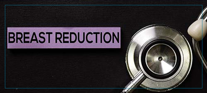 Benefits of Breast Reduction Surgery Q&A Benefits of Breast Reduction Surgery Q&A