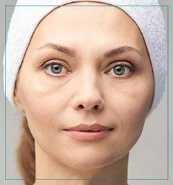 Eye Bag Removal Near Me in Fairfax, VA