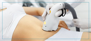 CoolSculpting Treatment Near Me in Fairfax, VA