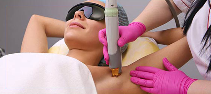 Benefits of Laser Hair Removal Near Me in Fairfax VA