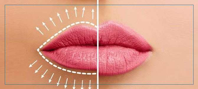 Lip Enhancement Treatment Near Me in Fairfax, VA Lip Enhancement Treatment Near Me in Fairfax, VA