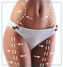 Liposuction Procedures Near Me in Fairfax, VA