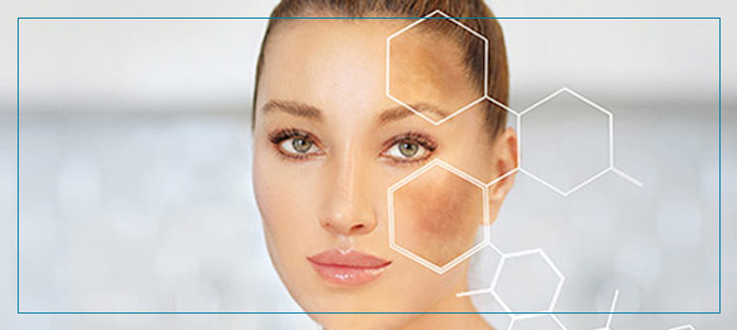 Melasma Treatment Near Me in Fairfax, VA