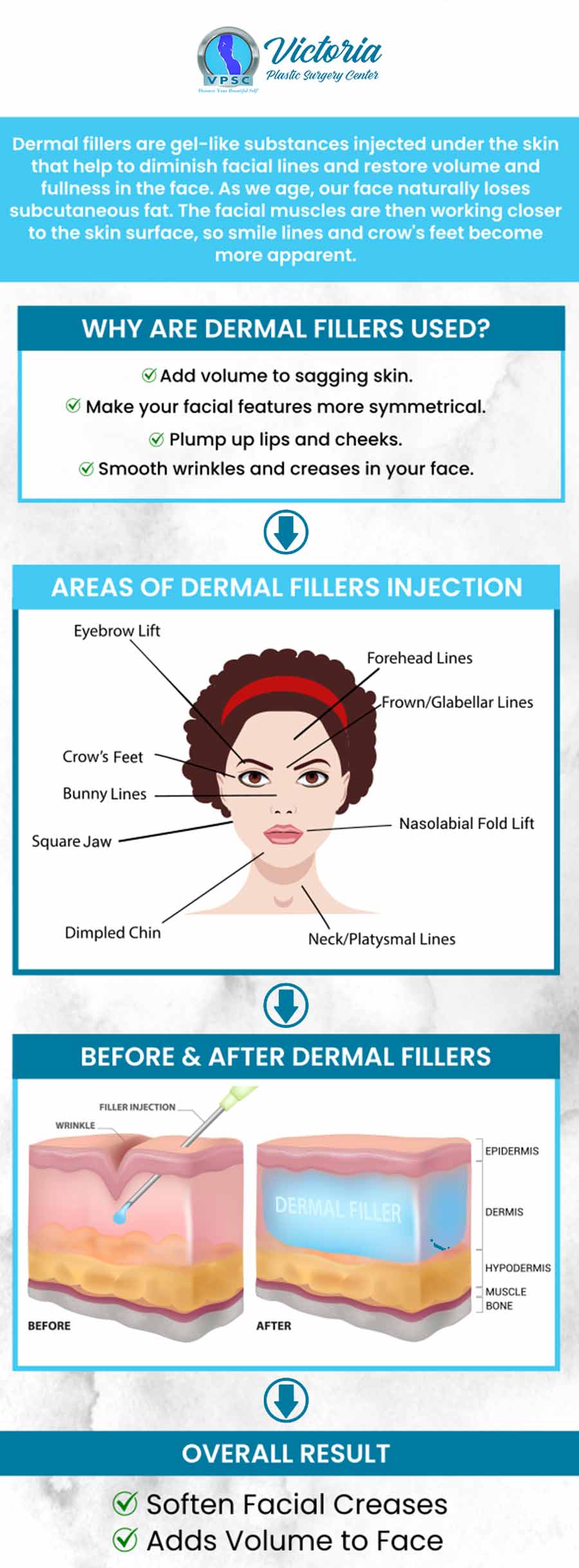 Looking to reduce fine lines and wrinkles? Do you want even skin with added volume? Dr. Suh at Victoria Plastic Surgery Center offers dermal Fillers at Victoria Plastic Surgery Center. Dermal fillers can help add volume to specific areas of the skin, to provide an even, more natural look.  For more information, please contact us or book an appointment online. We are conveniently located at 8503 Arlington Blvd #130 Fairfax, VA 22031