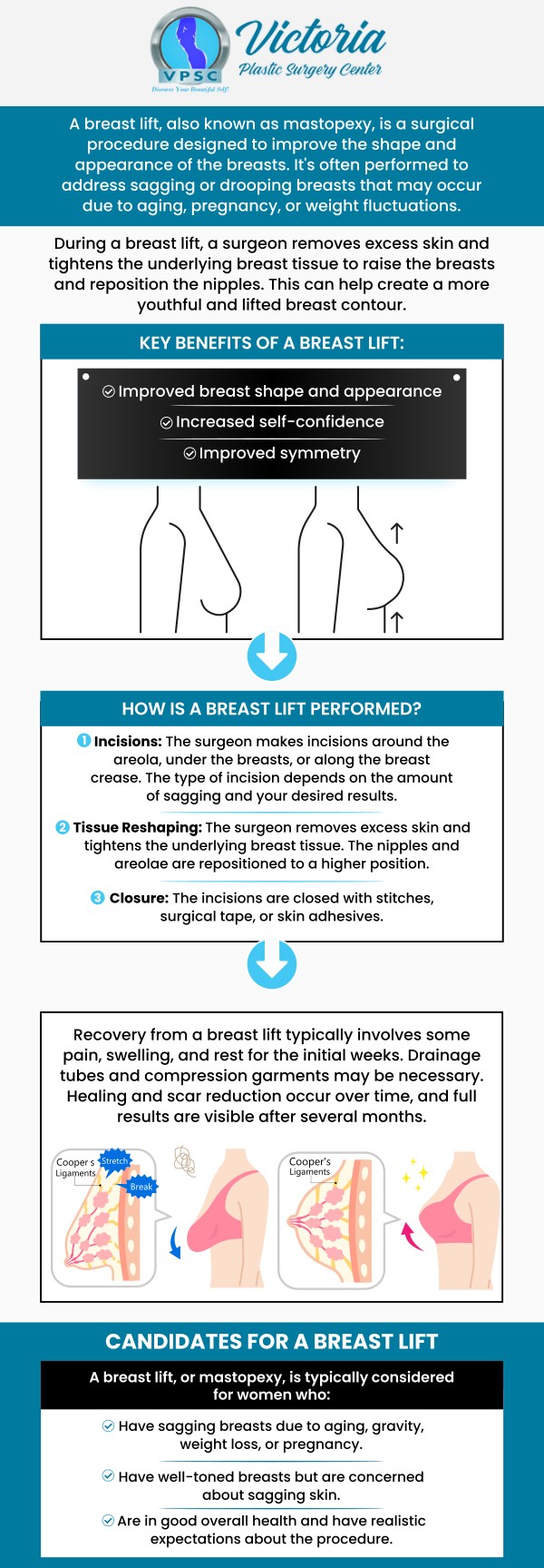 Common questions asked by clients: What is the best procedure for breast lift? What happens when you get a breast lift? How long does breast lift last? How much does it cost to lift my breast? Breast lift surgery is available at Victoria Plastic Surgery Center in Fairfax, VA. For more information, don't hesitate to get in touch with us or book an appointment online. We are conveniently located at 8503 Arlington Blvd #130 Fairfax, VA 22031. We serve clients from Fairfax VA, West Springfield VA, Vienna VA, Annandale VA, Burke VA, and surrounding areas. Common questions asked by clients: What is the best procedure for breast lift? What happens when you get a breast lift? How long does breast lift last? How much does it cost to lift my breast? Breast lift surgery is available at Victoria Plastic Surgery Center in Fairfax, VA. For more information, don't hesitate to get in touch with us or book an appointment online. We are conveniently located at 8503 Arlington Blvd #130 Fairfax, VA 22031. We serve clients from Fairfax VA, West Springfield VA, Vienna VA, Annandale VA, Burke VA, and surrounding areas.