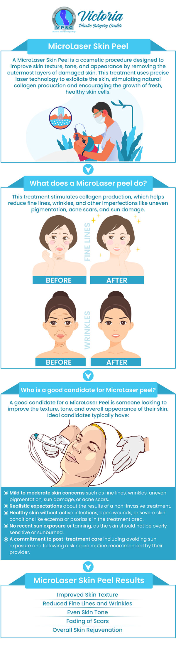 A micro laser peel is a quick and effective treatment that uses a special laser to address conditions on the top layer of your skin. It has many benefits such as smoothing your skin, even skin tone, increasing collagen production, and more. Dr. Suh at Victoria Plastic Surgery Center offers micro laser peels in Fairfax VA and surrounding areas. Contact us today for more information or book an appointment online. Visit us today at 8503 Arlington Blvd #130 Fairfax, VA 22031. A micro laser peel is a quick and effective treatment that uses a special laser to address conditions on the top layer of your skin. It has many benefits such as smoothing your skin, even skin tone, increasing collagen production, and more. Dr. Suh at Victoria Plastic Surgery Center offers micro laser peels in Fairfax VA and surrounding areas. Contact us today for more information or book an appointment online. Visit us today at 8503 Arlington Blvd #130 Fairfax, VA 22031.