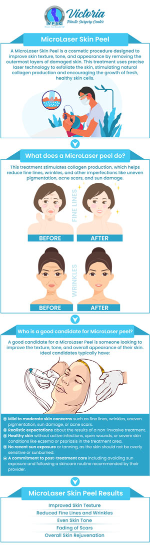 A micro laser peel is a quick and effective treatment that uses a special laser to address conditions on the top layer of your skin. It has many benefits such as smoothing your skin, even skin tone, increasing collagen production, and more. Dr. Suh at Victoria Plastic Surgery Center offers micro laser peels in Fairfax VA and surrounding areas. Contact us today for more information or book an appointment online. Visit us today at 8503 Arlington Blvd #130 Fairfax, VA 22031. A micro laser peel is a quick and effective treatment that uses a special laser to address conditions on the top layer of your skin. It has many benefits such as smoothing your skin, even skin tone, increasing collagen production, and more. Dr. Suh at Victoria Plastic Surgery Center offers micro laser peels in Fairfax VA and surrounding areas. Contact us today for more information or book an appointment online. Visit us today at 8503 Arlington Blvd #130 Fairfax, VA 22031.