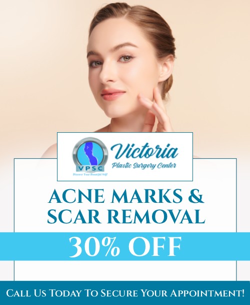 Are you worried because of the acne and the scars that you are left with? Dr. Suh at Victoria Plastic Surgery Center provides acne and scar therapies to treat your acne and surgical scarring. We are open 5 days a week. For more information, contact us or schedule an appointment online. Visit us at 8503 Arlington Blvd #130, Fairfax VA, 22031. Our friendly staff is looking forward to helping you look better and feel better!