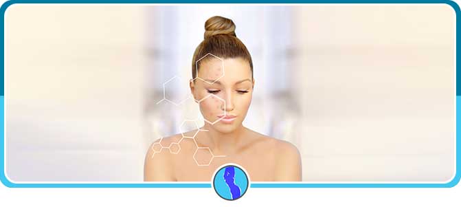Acne and Scar Treatment in Fairfax, VA Acne and Scar Treatment in Fairfax, VA